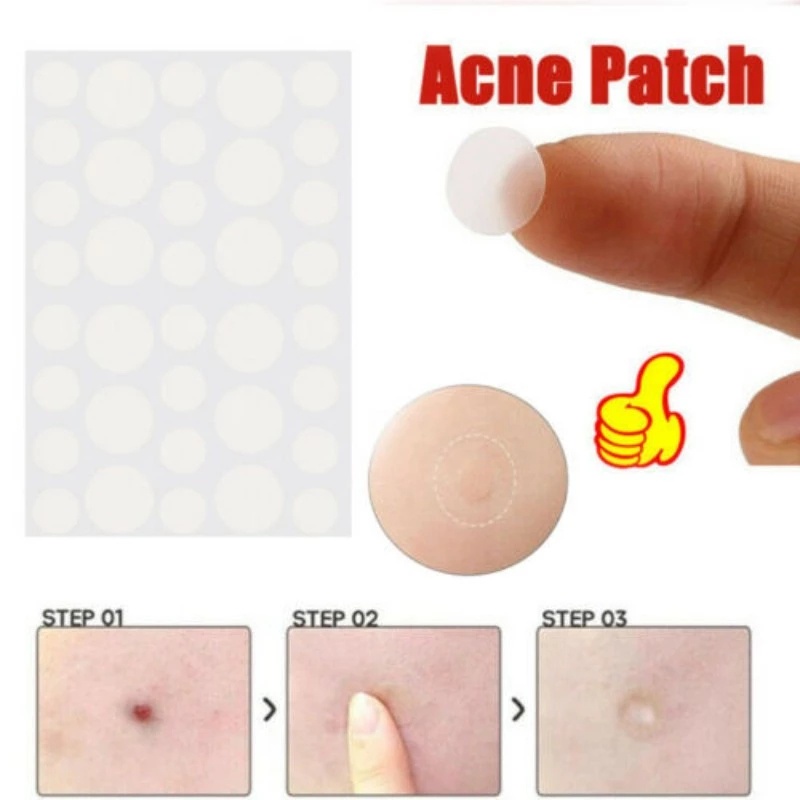 Pcs Waterproof Acne Patch Acne Pimple Patch Invisible Stickers