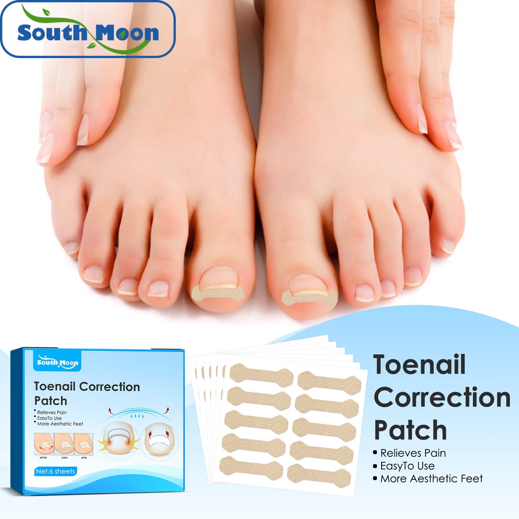 South Moon 60pcs Toenail Correction Patch Ingrown Toenail Patches