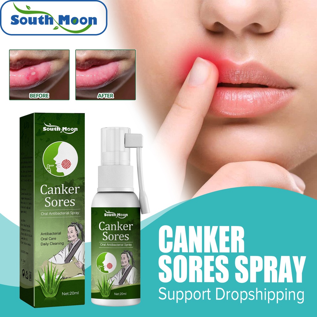 South Moon Ml Oral Ulcer Spray Treatment Pharyngitis Halitosis Sore