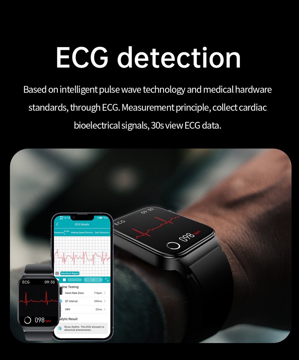 E Blood Glucose Smart Watch Ecg Monitoring Blood Pressure Body