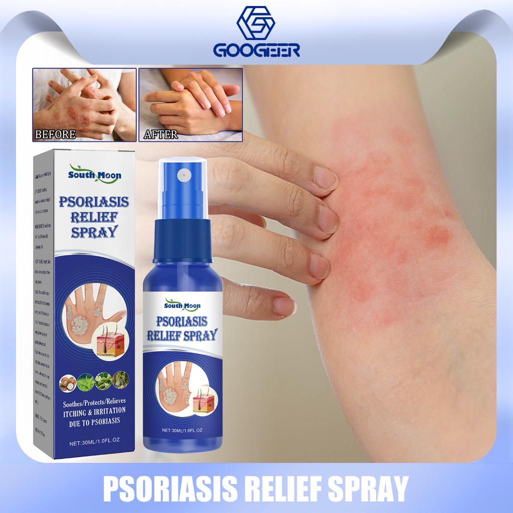 South Moon Psoriasis Relief Spray Skin Psoriasis Spray Natural Herb