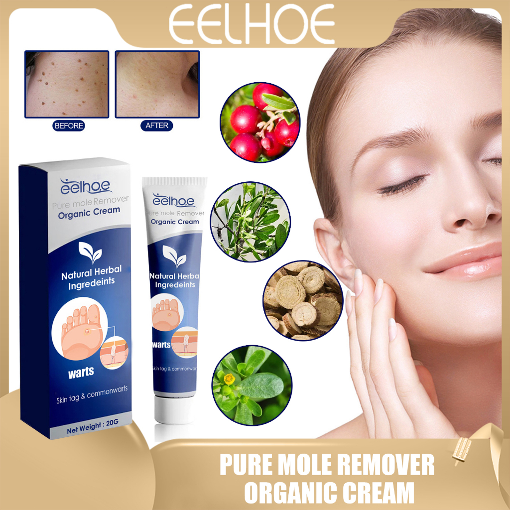 Eelhoe Pure Mole Remover Organic Cream Skin Tags Remover Warts Remover