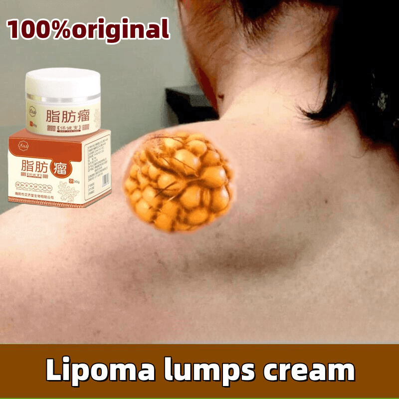 Lipoma Removal Cream Lipoma Cream Lump Removal 30g Safe Painless Remove