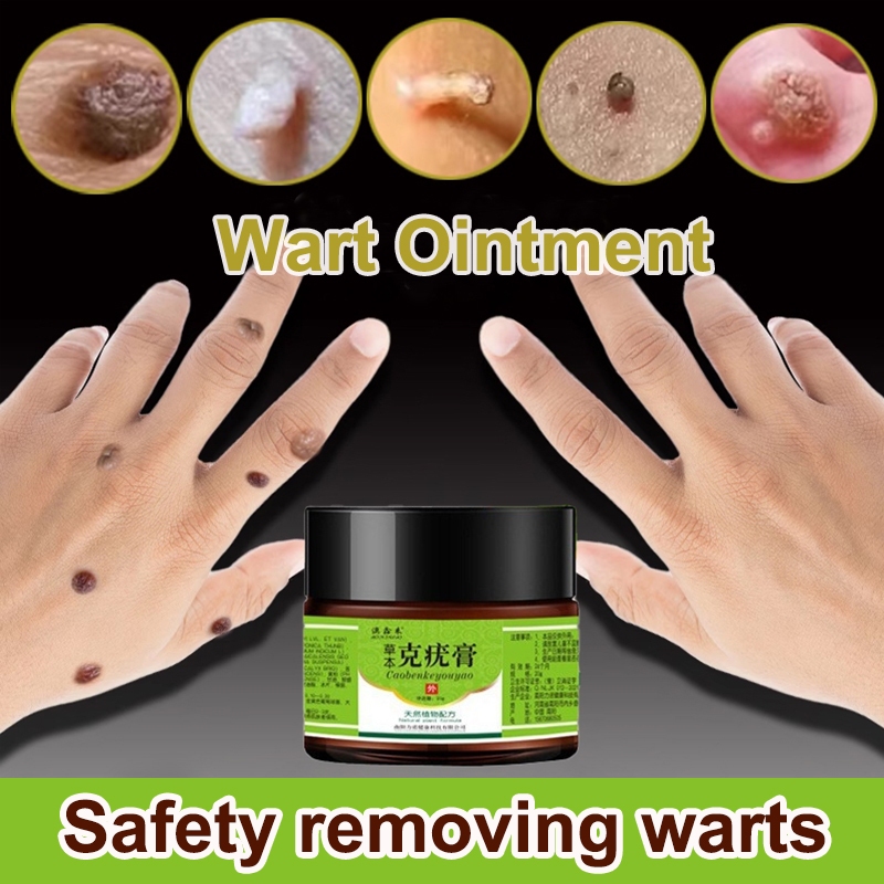 Wart Removal Cream Skin Tag Remover Wart Treatment Cream Effectively