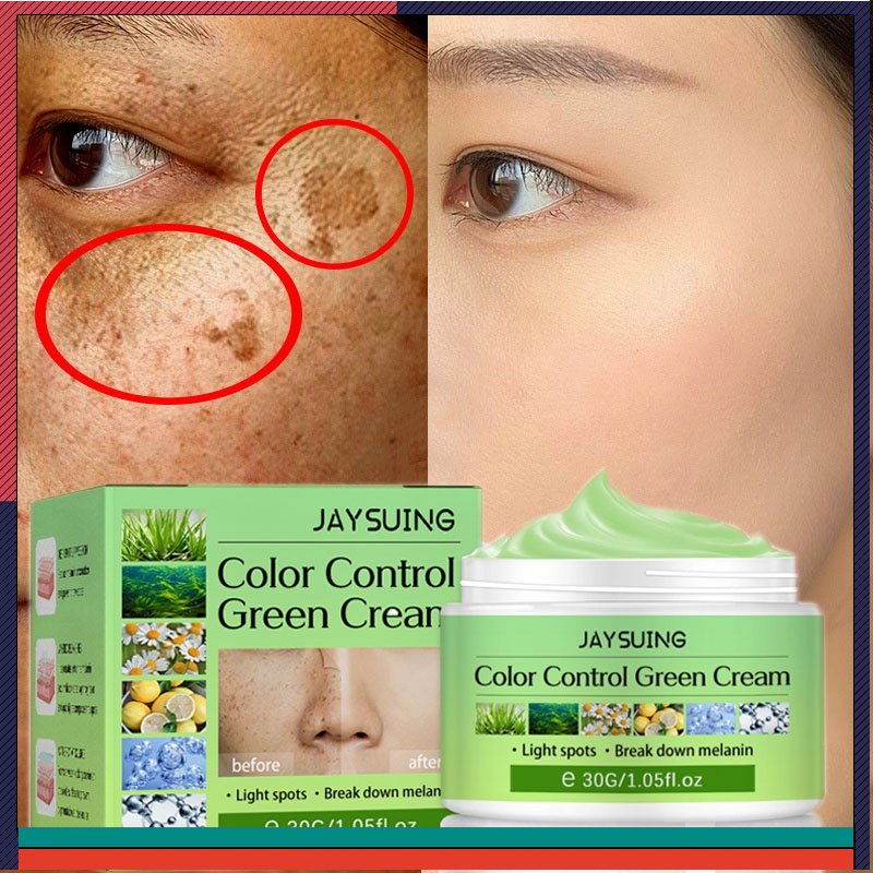 Remove Melasma Dark Spot Whitening Freckles Cream Lightening Melanin