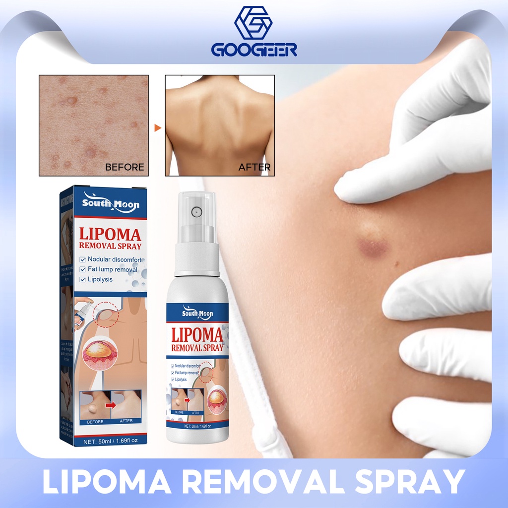 South Moon Lipoma Removal Treatment Spray Chinese Herbal Medicine Body