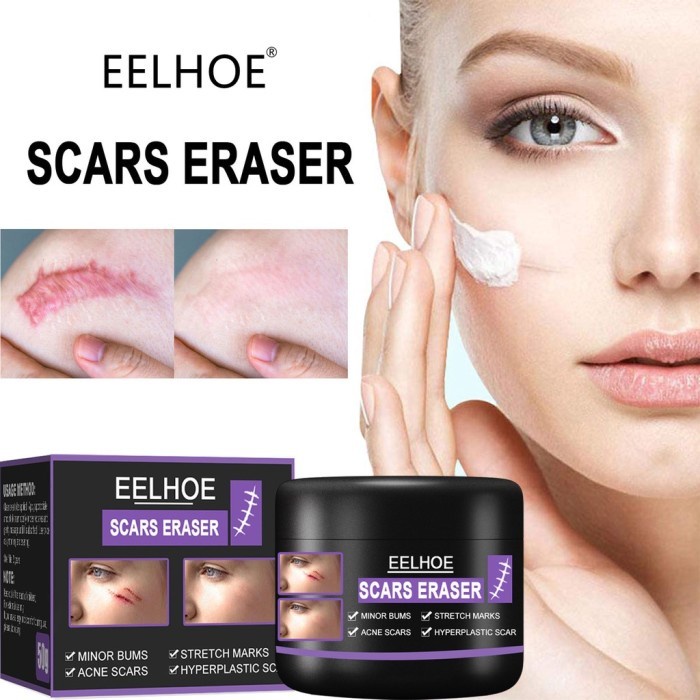 Eelhoe Scar Remover Gel Cream Acne Scar Remover Acne Shopee Singapore