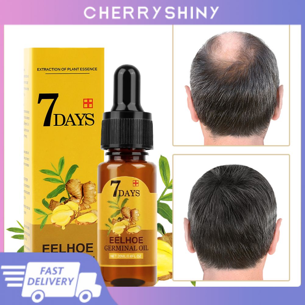 HOT Eelhoe Hair Growth Ginger Germinal Oil Effective Hair Loss