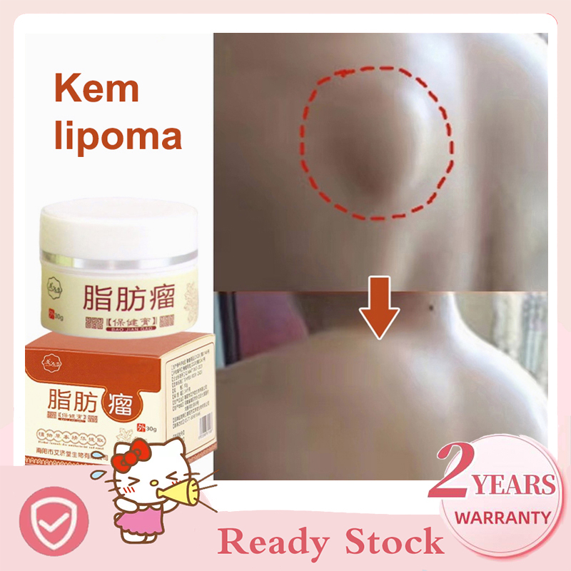 Lipoma Cream Lipoma Removal Cream 30g Quickly Remove Fatty Lumps