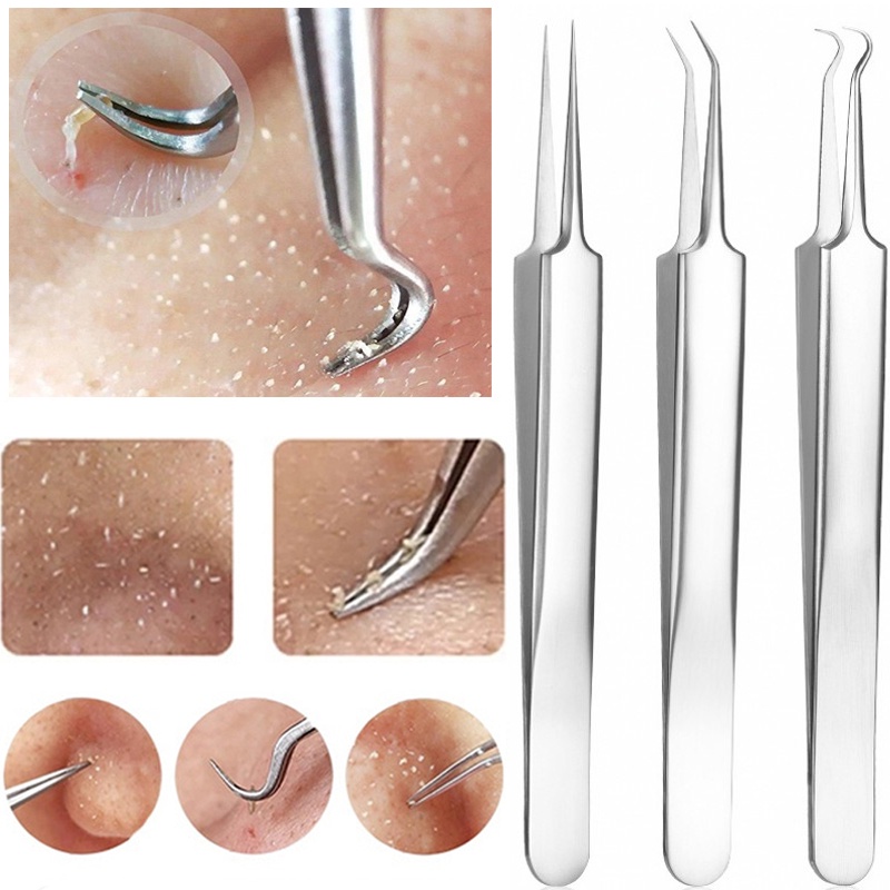 Stainless Steel Acne Needle Tweezers Blackhead Blemish Pimples Removal Pointed Bend Gib Head