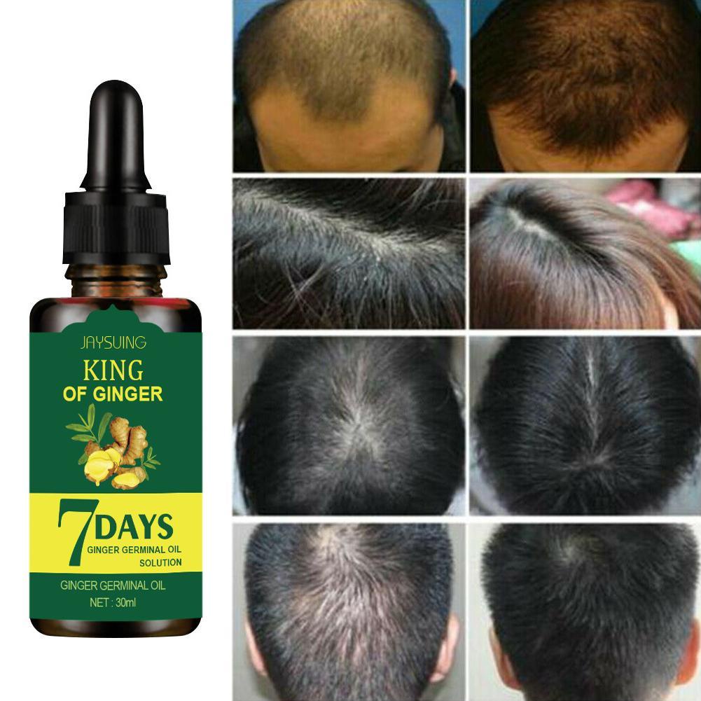 Jaysuing King Of Ginger 7 Days Ginger Hair Nutrient Solution Ginger Germinal Oil 30ml Per 3351