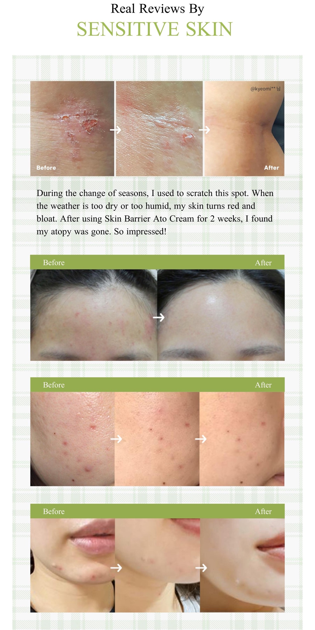 OxygenCeuticals Skin Barrier Ato Cream 20ml | Shopee Singapore