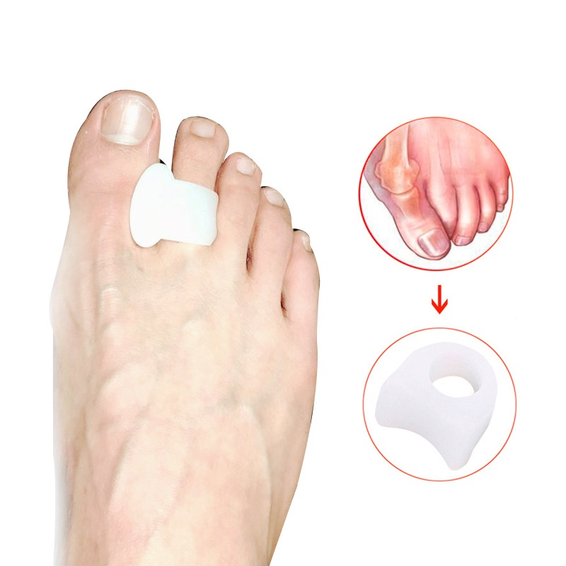 Toe separator, toe orthosis. Big Toe Straightener Thumb Valgus ...