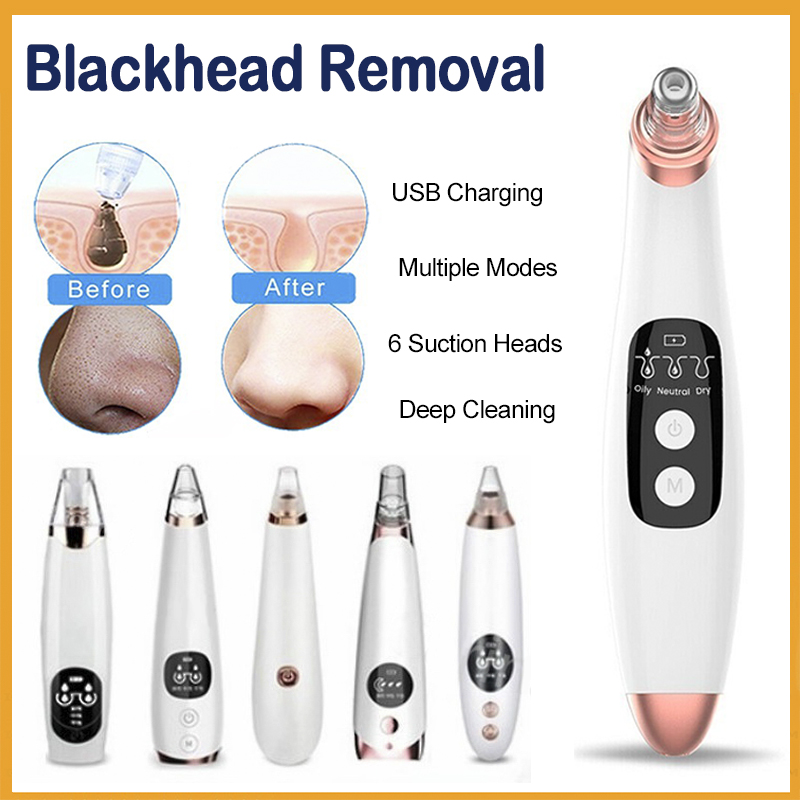 Wireless Electric Blackhead Remover Pore Vacuum Acne Pimple Removal ...