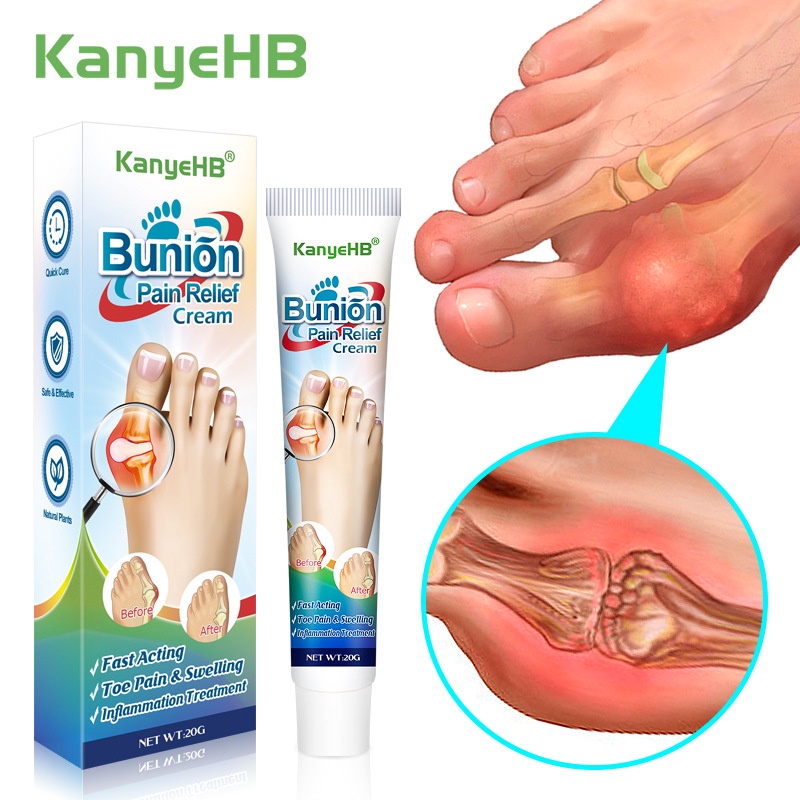 KanyeHB Heel Pain Bunion Pain Heel Pain Relief Cream Heel Pain Foot ...