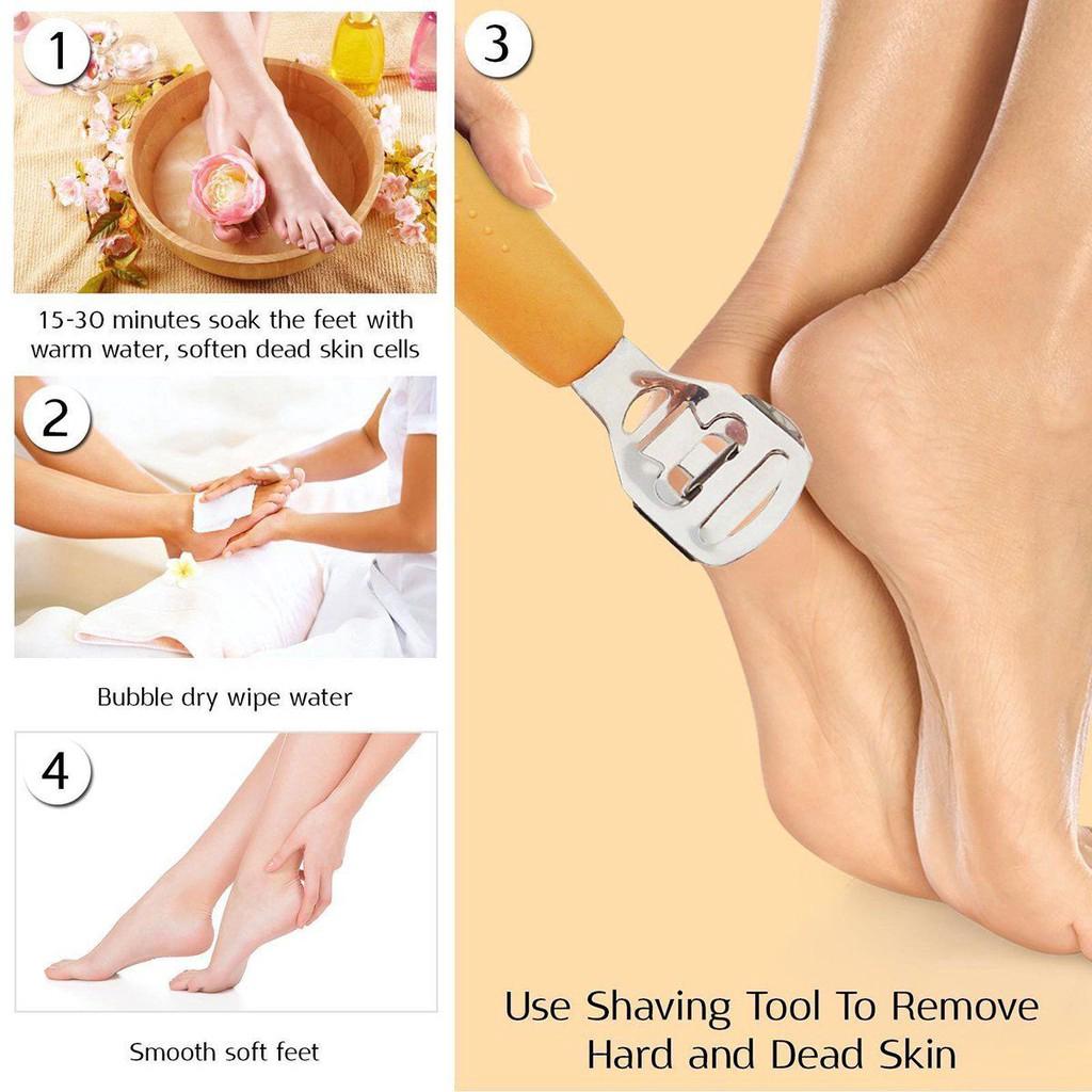13 Pieces Callus Shaver Set, Pedicure Foot Shaver Callus Remover -  Professional Heel Callous Corn Removal Metal Scraper with 10 Blades and 1  Foot File Head,Hard Dry Skin Remover for Hand Feet 
