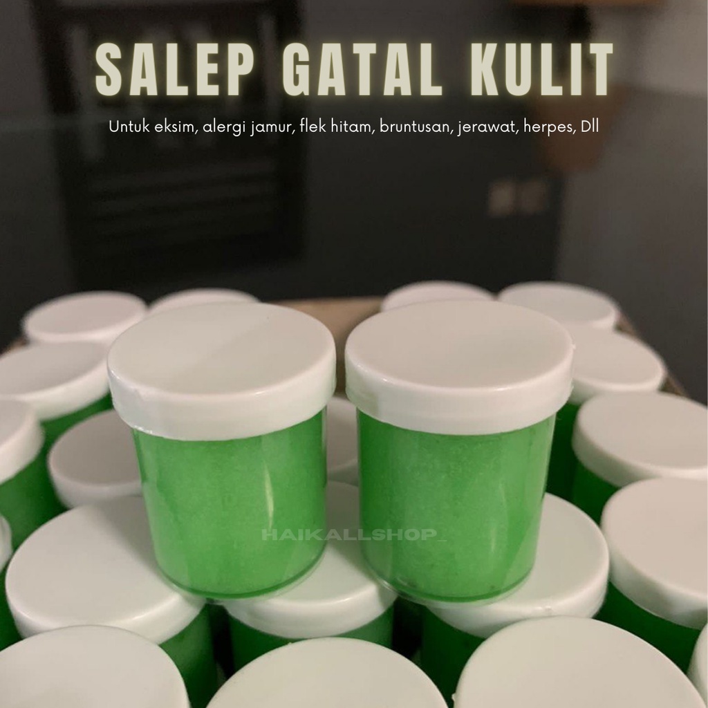 Versatile Ointment, Skin Itching Ointment, Eczema Ointment, Acne