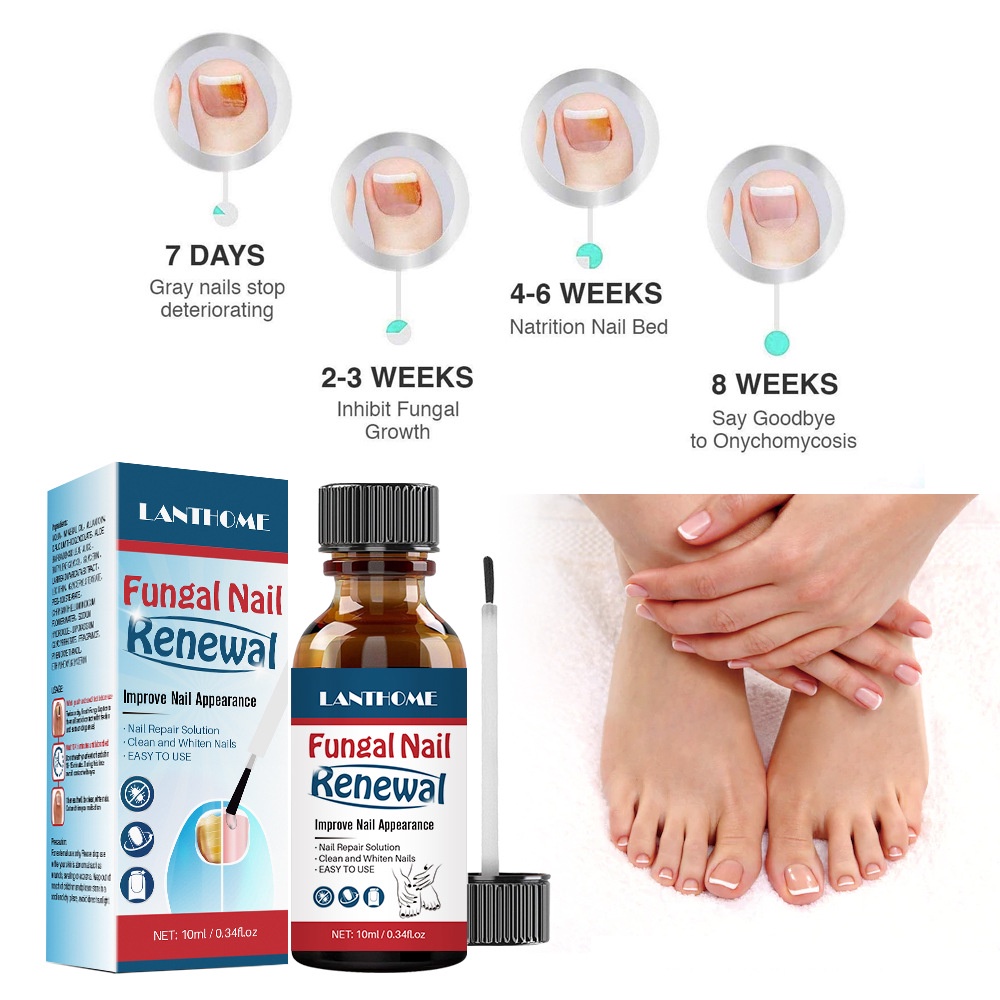 Original Lanthome Herbal Fungal Nail Renewal / Nail Repair And Whitening Treatment 10ml Ready
