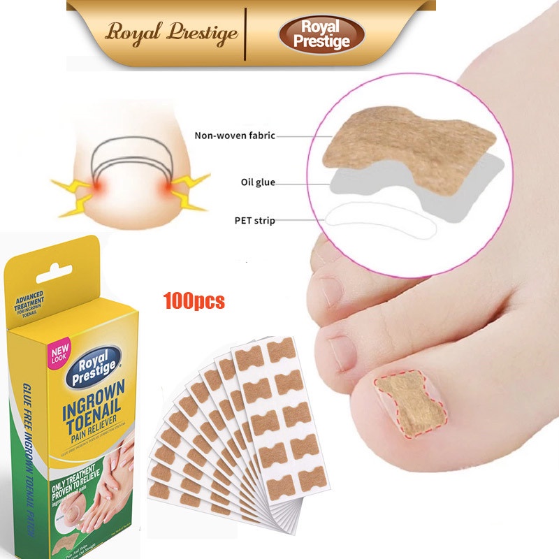 100pcs Paronychia Ingrown Toenail Correction Stickers Toenails Band Aid