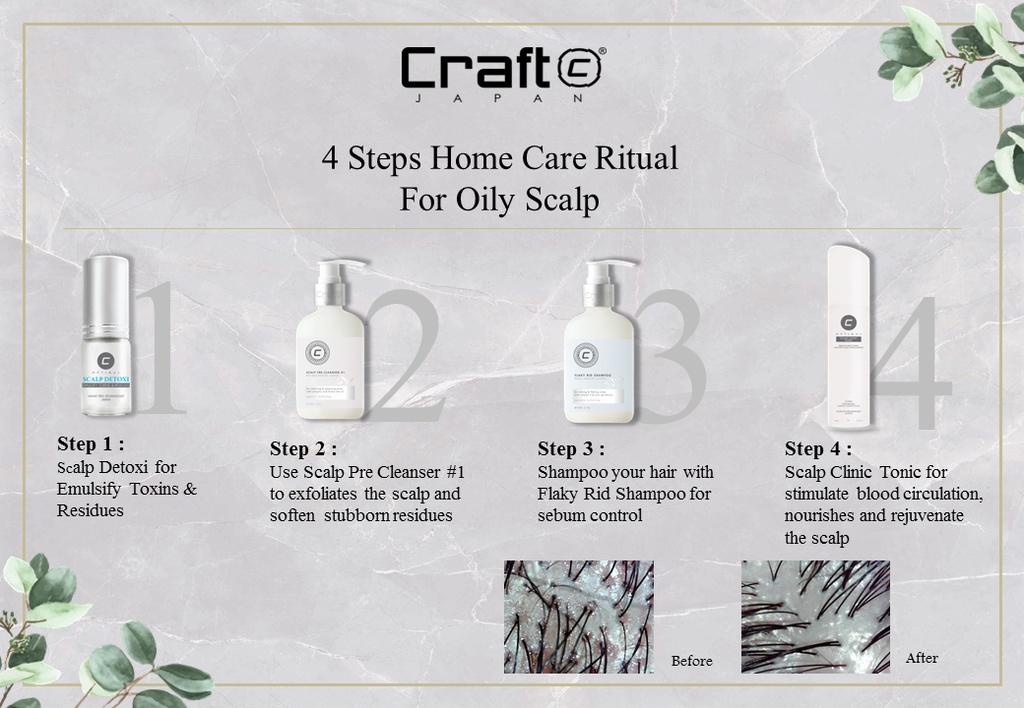 Craft Scalp Clinic Shampoo 300ml 1000ml ( For Energizing & Thinning ...