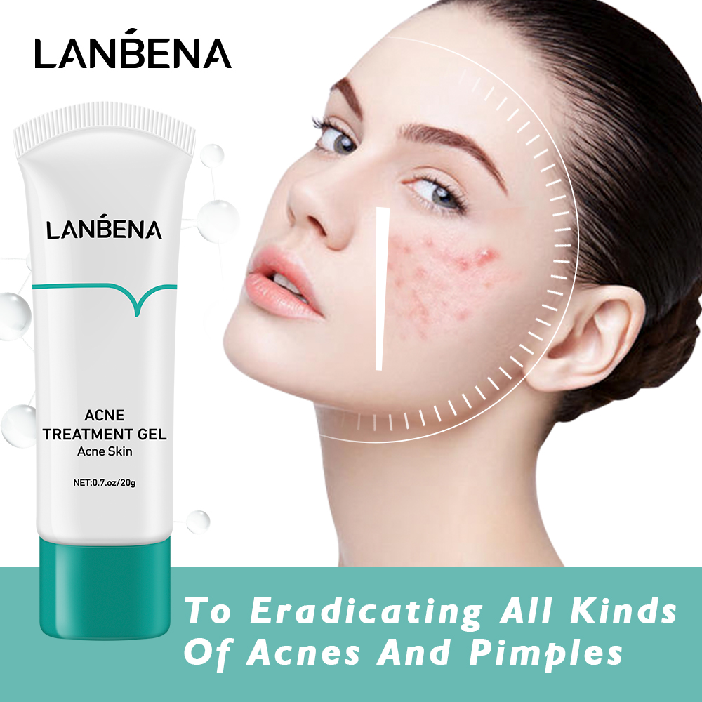 LANBENA Acne Treatment Cream | Shopee Singapore