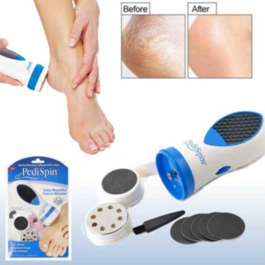 PediSpin Electronic Foot Callus Removes Calluses Dry Rough Skin Corn ...