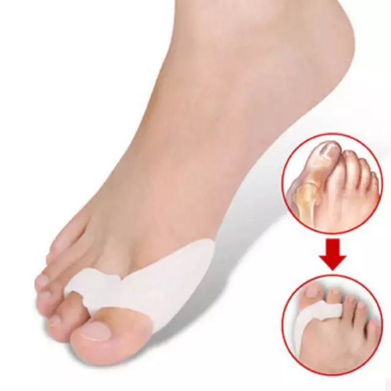 silicone Reduces The Friction Of The Bone Of The Feet. Convex Foot ...