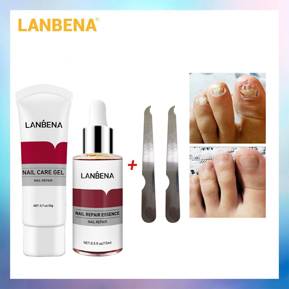 LANBENA Nail Care Gel+Nail Repair Essence Serum Nail Treatment Remove ...