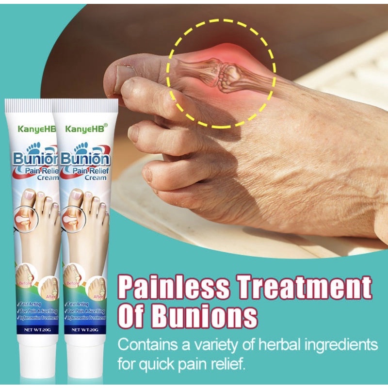 Natural Bunion Relief Cream AntiInflammatory Ointment for Foot Pain