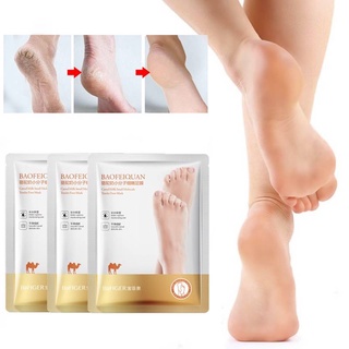 Foot Peel Mask, 2 Pcs / Bag Mango Dead Skin Remove Cuticles Foot  Moisturizing Exfoliating Exfoliating Callus Remover