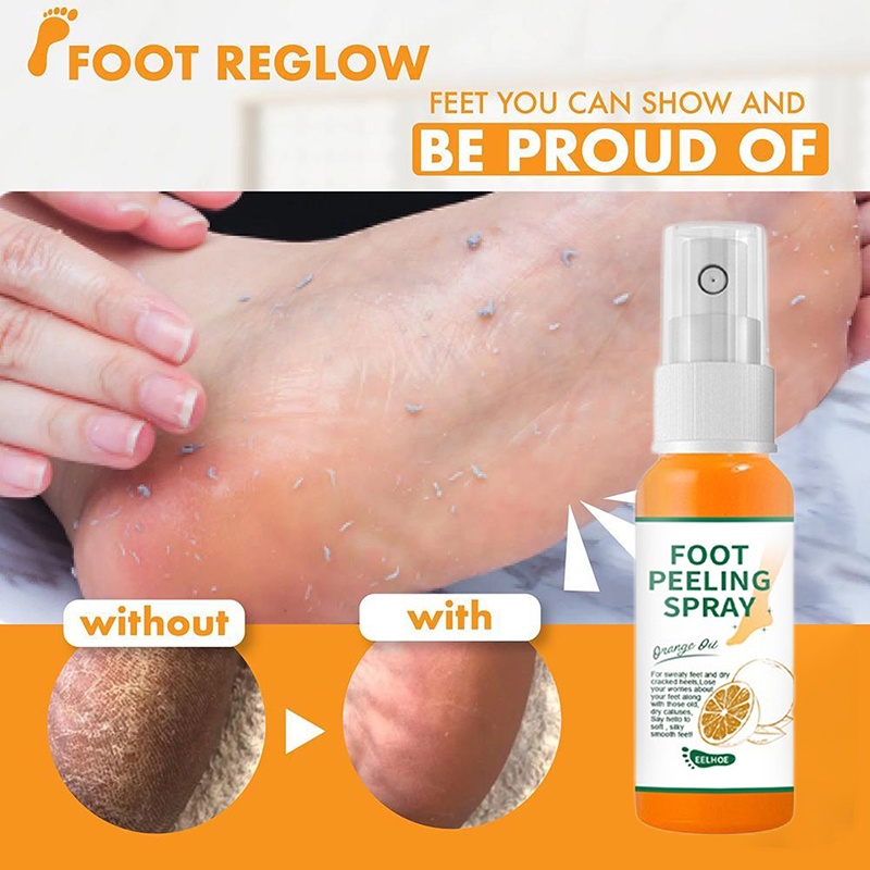 Foot Exfoliating Spray Foot Care Spray To Remove Dead Skin On Feet