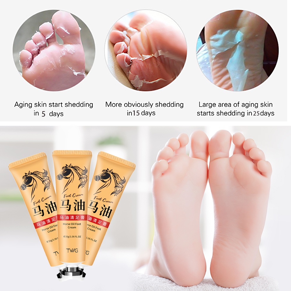 Feet cream to on sale remove dead skin