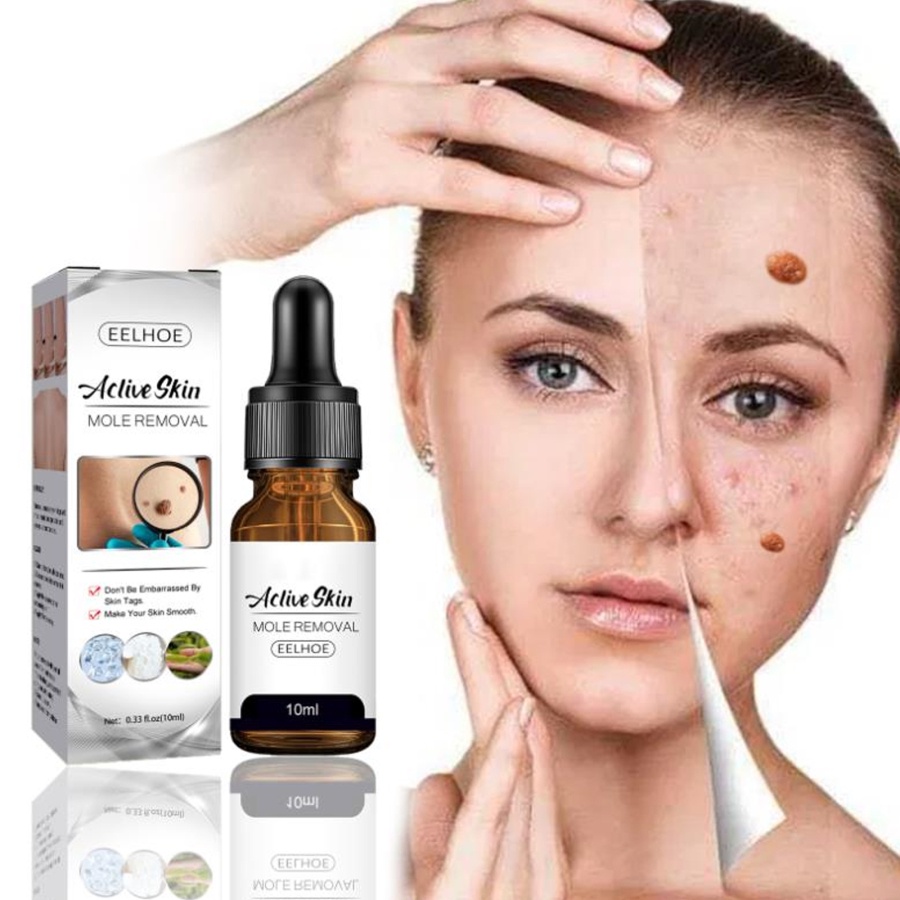 LLKQQ Wart Removal Essence Wart Treatment Neck Skin Tag Armpit Flat