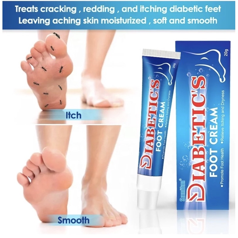 Sumifun Diabetes Foot Cream for Irritation and Itch Relief; Anti ...