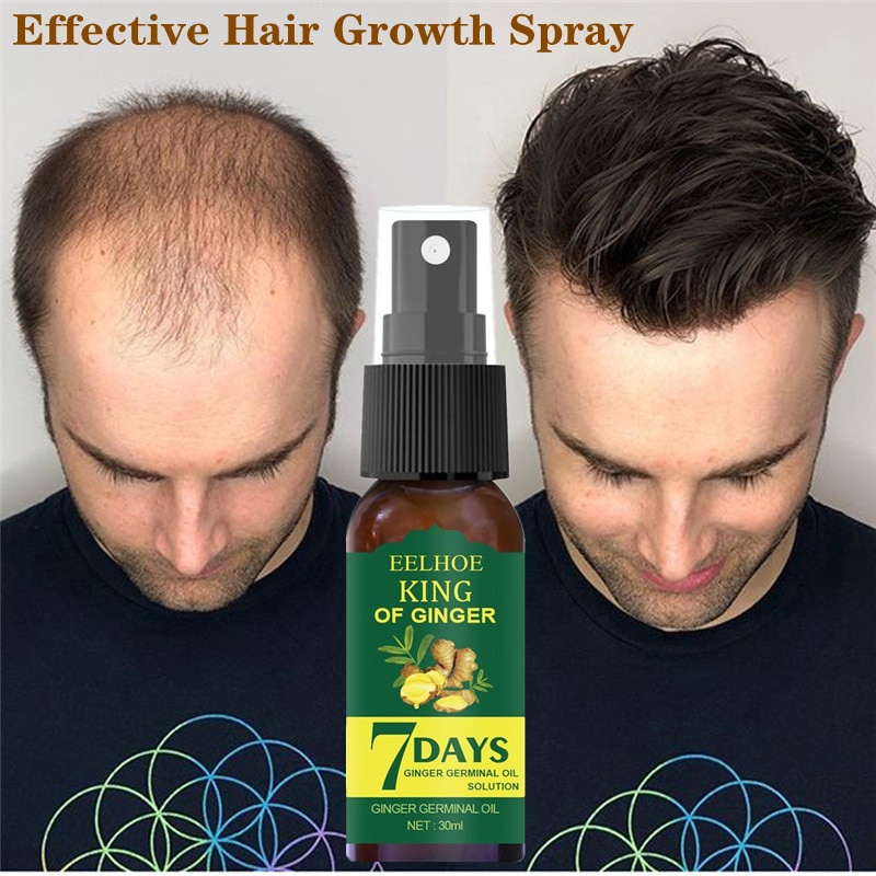 Eelhoe Hair Growth Essence Germinal Serum Essence Oil Natural Hair Loss Treatement Effective 6037