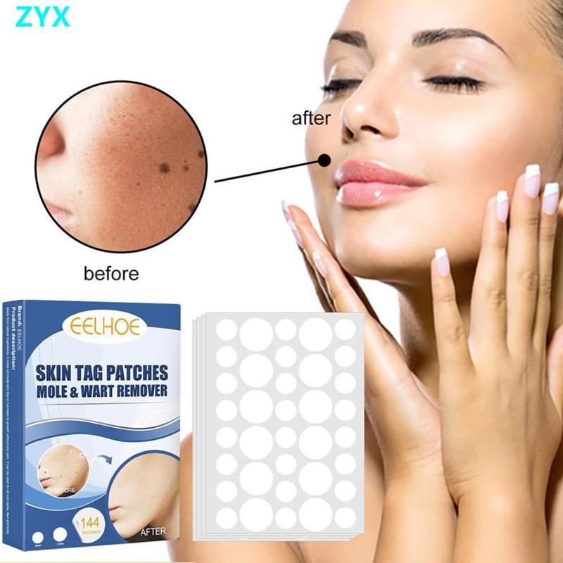 144pcs Skin Tag Remover Patches Skin Tag Remover Pads Covers Conceals ...