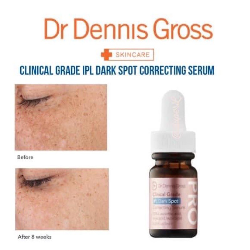 [Dr Dennis Gross] Serum Dr Dennis Gross Clinical Grade IPL Dark Spot ...