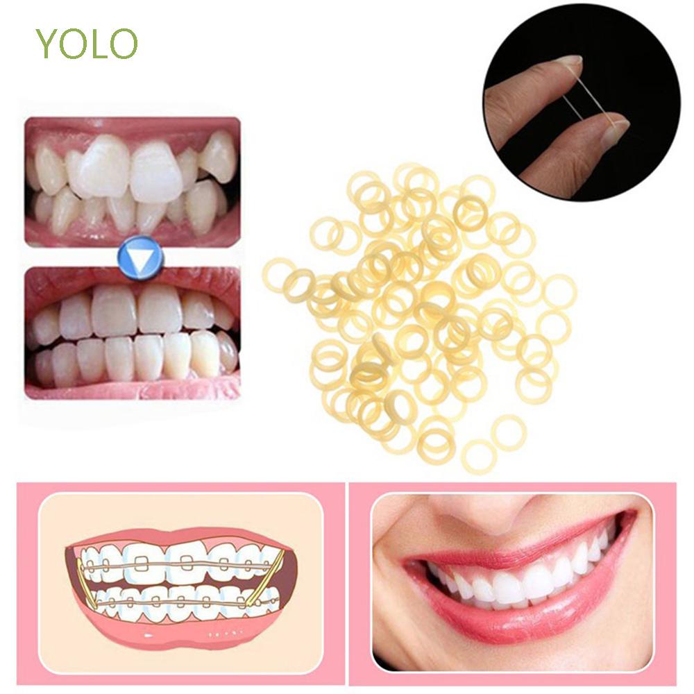 YOLO 100pcs/bag Dental Orthodontic Rings Orthodontic Orthodontic Braces