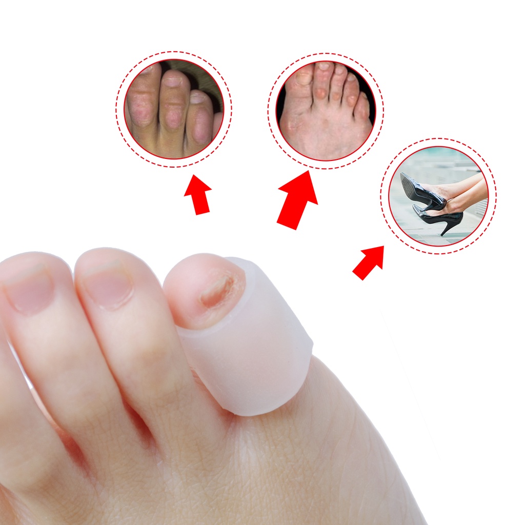 2pcs Transparent Gel Hammer Toe Protector German Style Open Sleeve ...