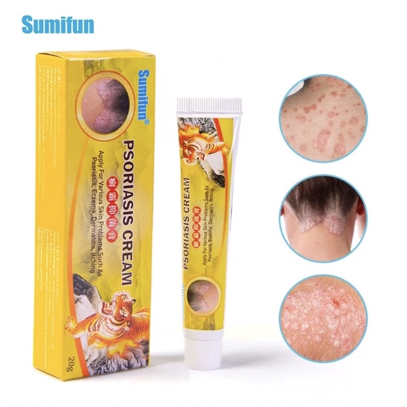 Eczema Psoriasis Dermatitis Ointment Herbal Antibacterial Anti Itch ...