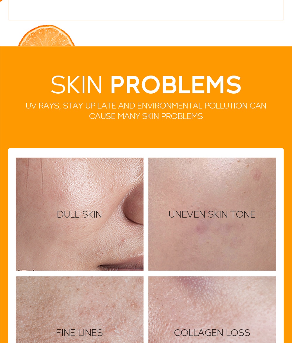 FENYI Vitamin C Whitening Cream VC Face Moisturizer Refreshing