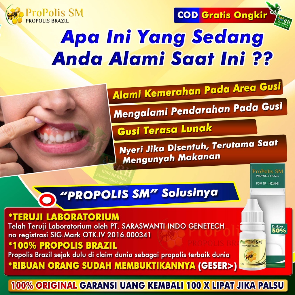 sm-dental-gum-disease-medicine-swelling-gum-bleeding-gum-lumps-in