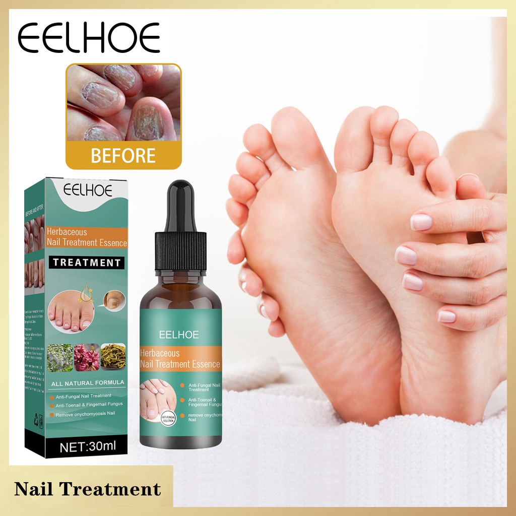EELHOE Nail Repair Essence Serum Fungal Nail Treatment Remove