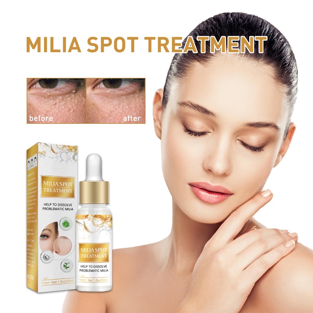 Milia Remover Essence Milia Spot Treatment Helps Dissolve and Reduce ...