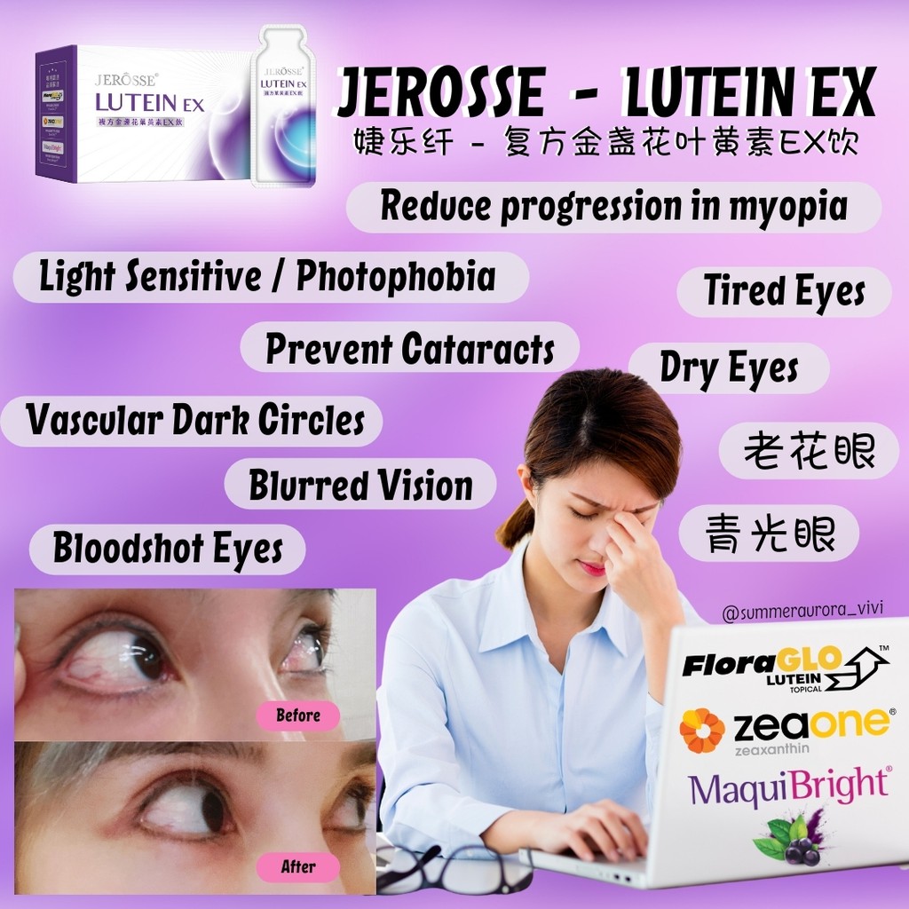 new-lutein-ex-eye-health-dry-eyes-tired-eyes-burred-vision