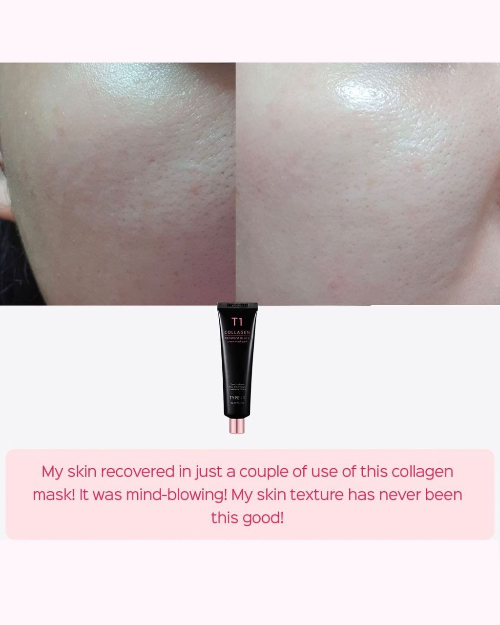 (DR. SIMFLE OFFICIAL STORE) Stick Black Premium T1 Collagen 100 Mask ...