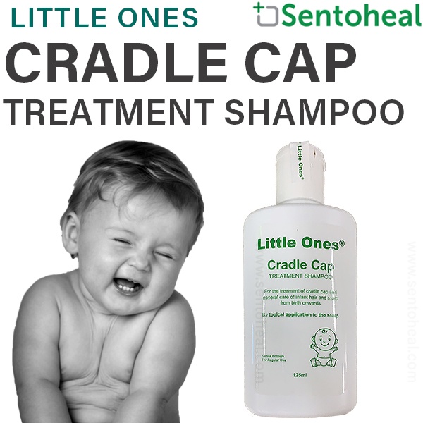 Shampoo to treat cradle sales cap