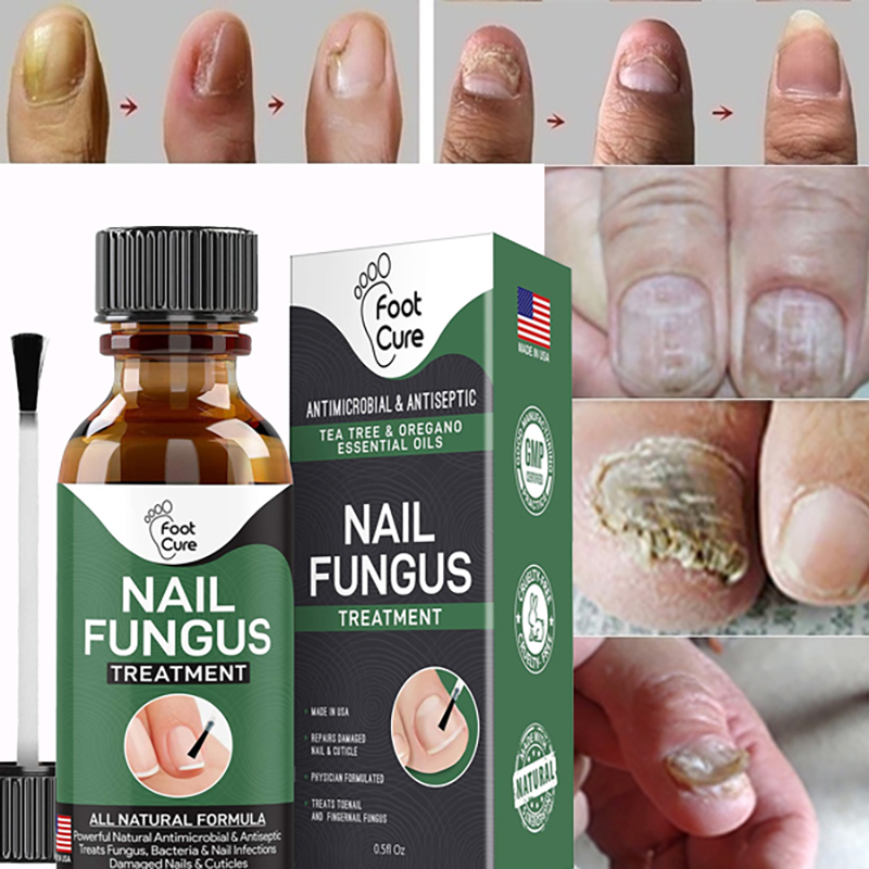 Cure for deals nail fungus