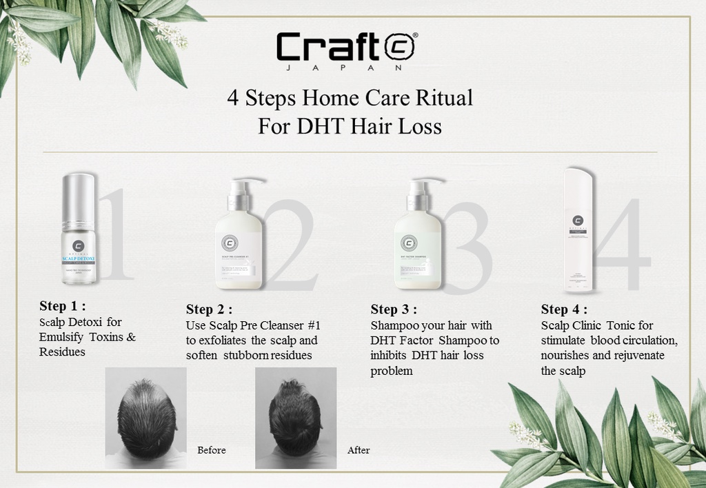Craft Scalp Clinic Shampoo 300ml 1000ml ( For Energizing & Thinning ...