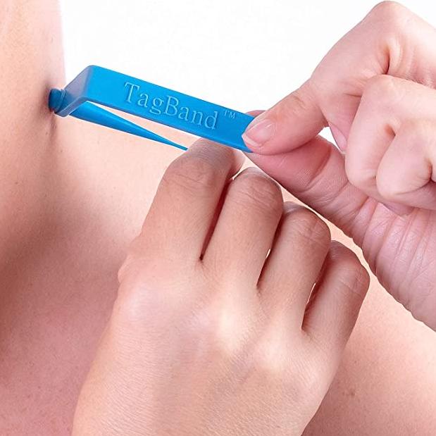 Xovq)) Skin Tag Rubber Band Removal Tool Kit Moles And Moles Removal